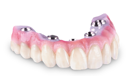 Implantat
